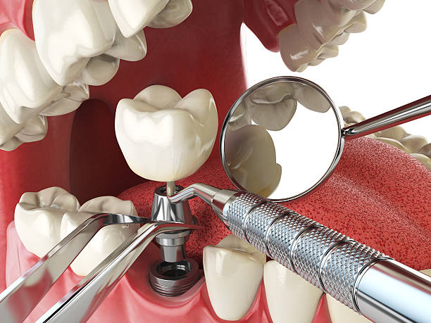 Best Broken or Cracked Tooth Emergency Dentist in Edison, GA
